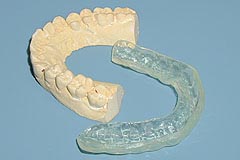 歯軋り防止装置と歯型