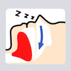 いびき・睡眠時無呼吸症候群(SAS)